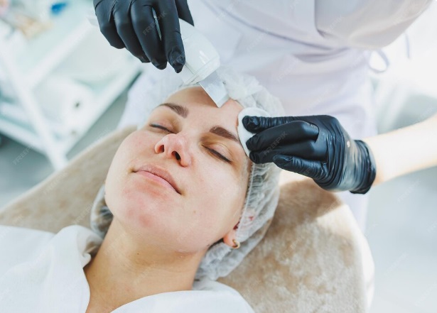 Limpeza de sobrancelhas